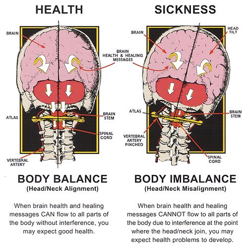upper neck posture balance health v sickness.jpg, Mar 2022